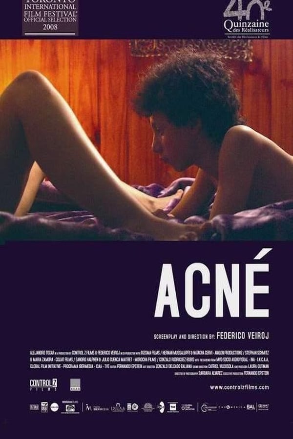 Cover of the movie Acne